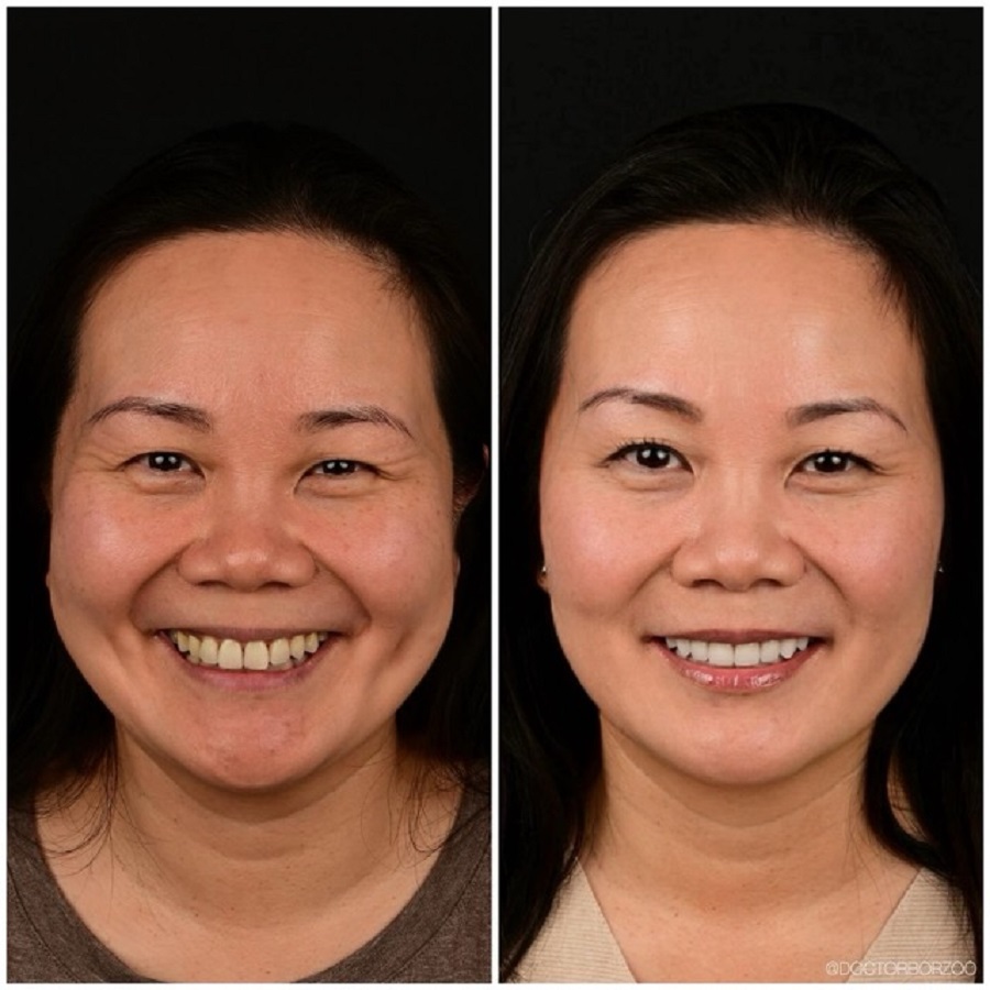 Dr. Borzoo Ahmadi DDS - Cosmetic Dentist