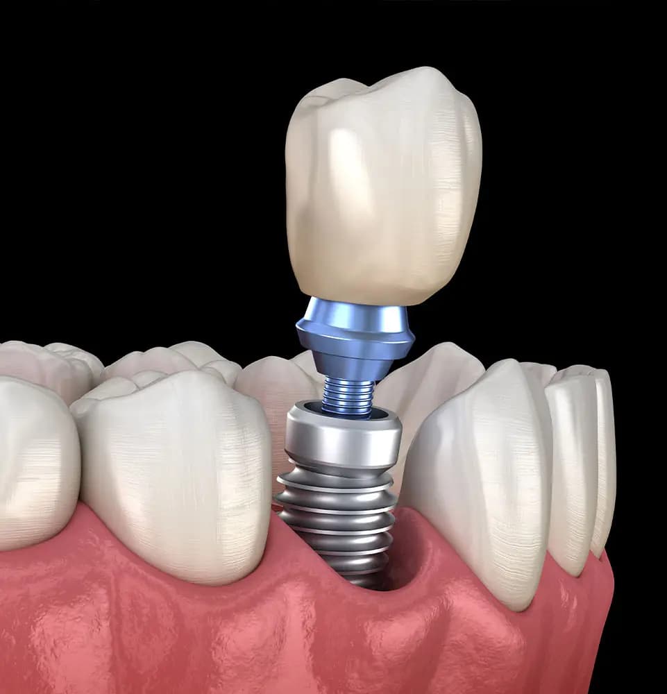 Richardson Family & Implant Dentistry - Gallery 2