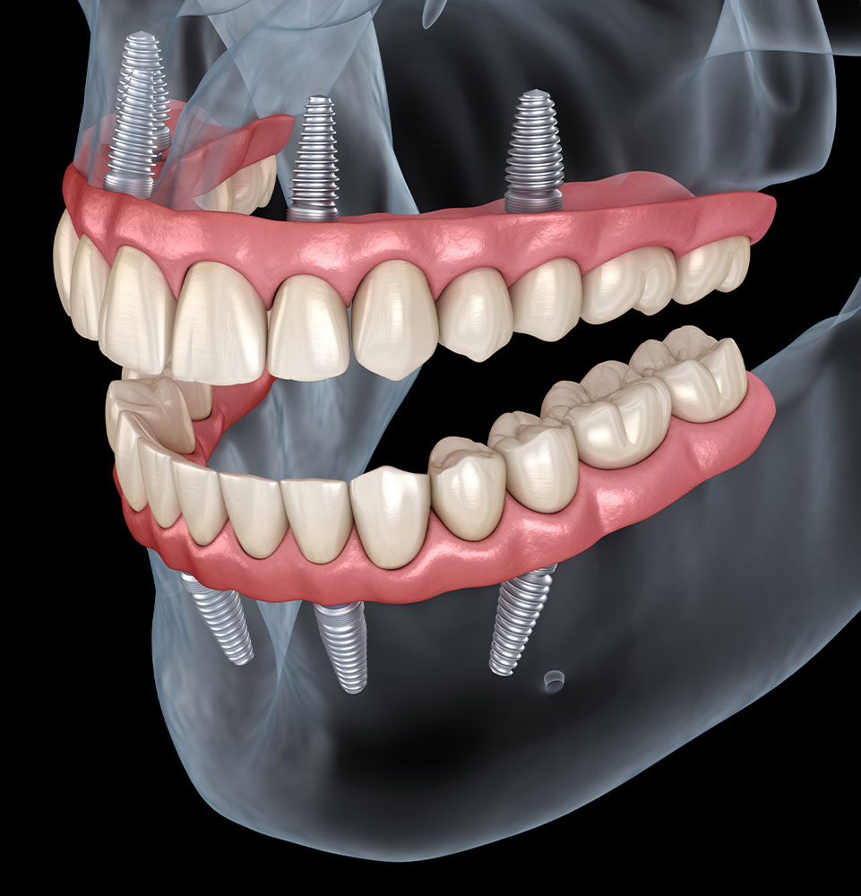 Richardson Family & Implant Dentistry - Gallery 3