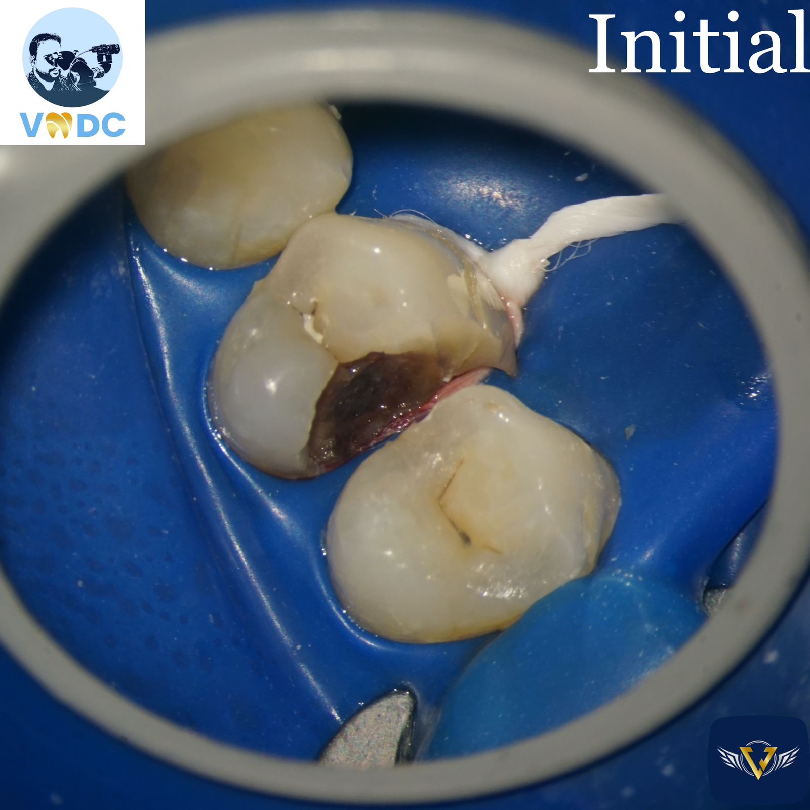 vejai Micro Dentistry Center - Gallery 4