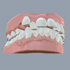 Kristelle Klear Aligners - Gallery 2