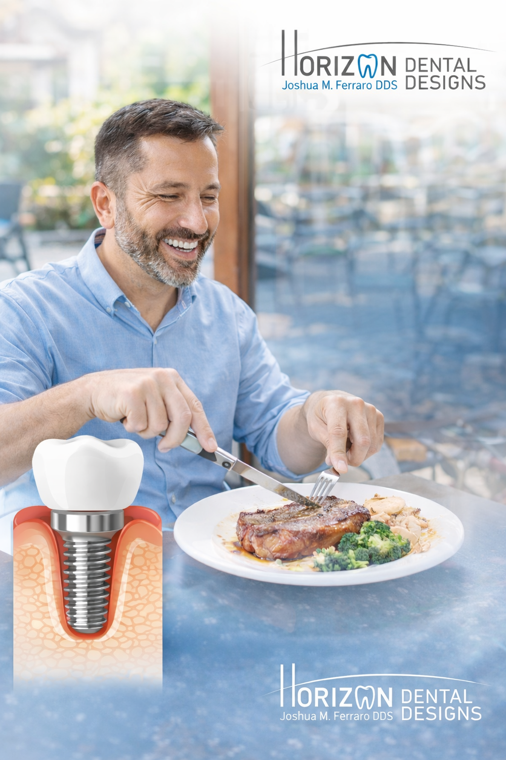 Horizon Dental Designs - Dentist Plant City - Gallery 6