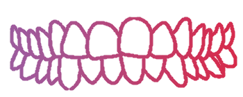 Kristelle Klear Aligners - Gallery 1