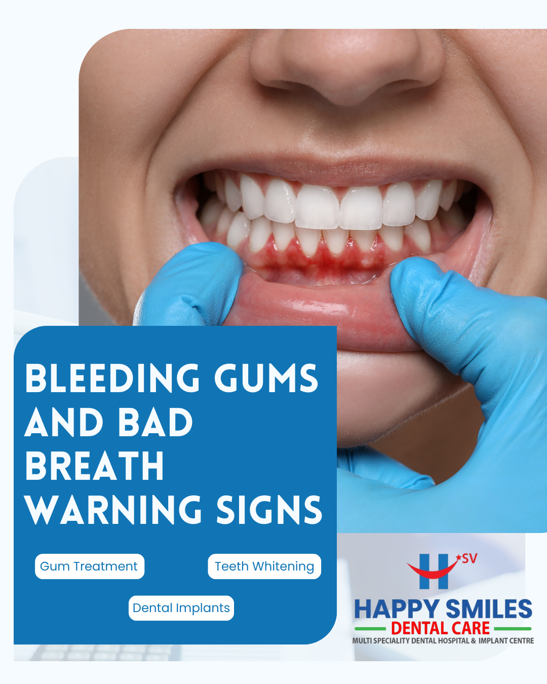 happysmilesdentalhospital - Gallery 1