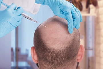 Want Hair - Gallery 1