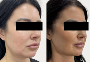 Skin & Laser Clinic Armadale, Melbourne - Gallery 4