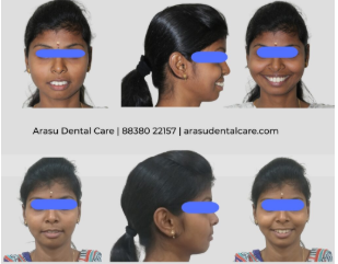 Arasu Dental Care - Gallery 1