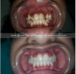 Arasu Dental Care - Gallery 2