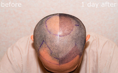 Want Hair - Gallery 4