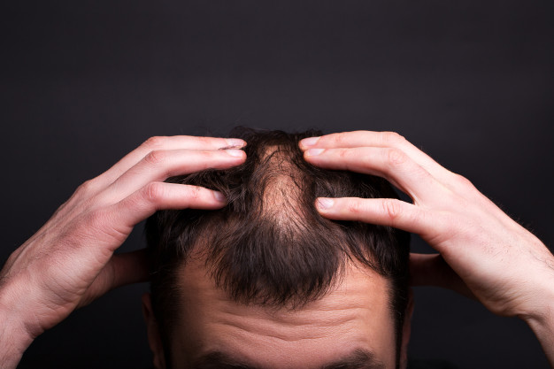 Want Hair - Gallery 5
